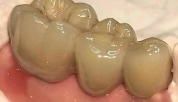 Pizerchio odontologia - Valença