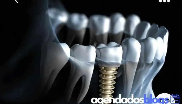Pizerchio Odontologia -  Do Proprietario - Valença